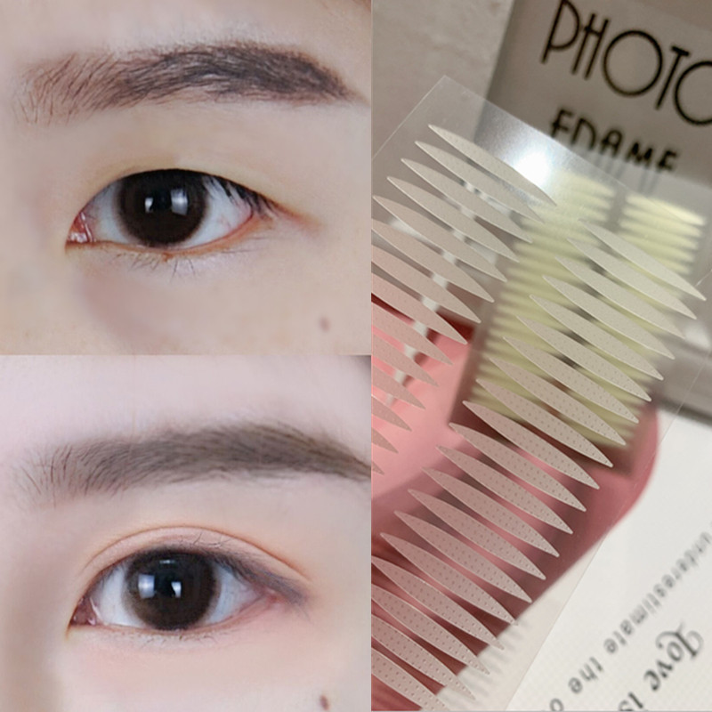 内双肿眼泡专用双眼皮贴