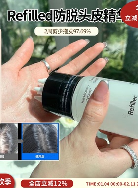 刘仁娜推荐 Refilled肪脱生发头皮精华化解OY弟一蓬松控油孕妇可