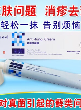 头皮屑牛皮鲜止痒抑菌皮肤瘙痒头藓康抑菌霜真菌膏感染股软膏谱语