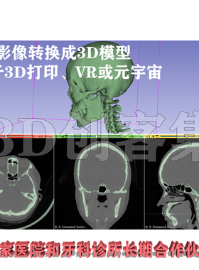 医学CT影像3D建模DICOM转3D打印格式stl牙科骨科人体结构三维重建