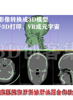 CT三维重建3D打印stl，案例数百