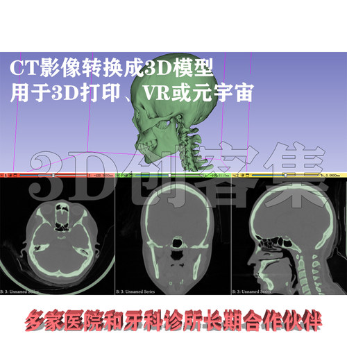 CT三维重建3D打印stl，案例数百