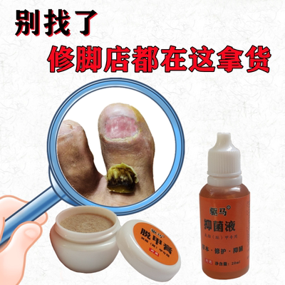 灰指甲药抑菌专用液无痛去除增厚脱甲膏软甲灰甲净冰醋酸外用正品