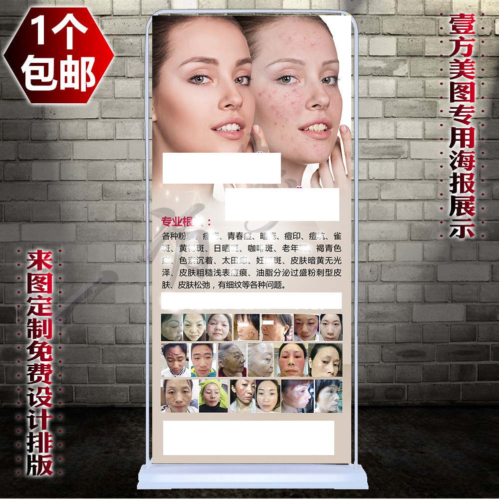 包邮专业祛斑祛痘广告海报宣传画祛疤对比图中药展架祛斑祛痣广告