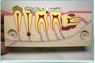 右下后牙组织分解模型牙齿解剖牙列模型口腔齿科科教学 ENOVO颐诺