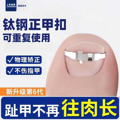 甲沟矫正器嵌甲矫正贴片卷曲甲脚趾甲往肉里长纠正专用正甲扣炎
