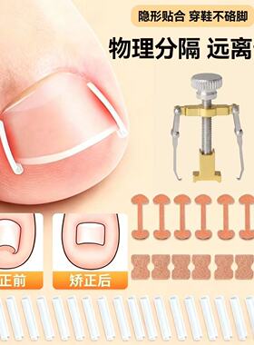 甲沟矫正器嵌甲贴片脚指甲往肉里长专用正甲贴炎指甲隔离垫