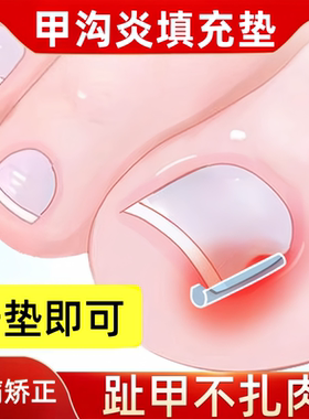 甲沟矫正神器嵌甲矫正贴片隔离大脚趾甲长肉里指甲矫正器正甲垫炎