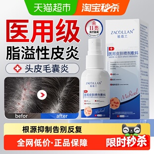 头皮屑脂溢性皮炎真菌感染头癣头去屑部喷雾剂止痒膏药牛皮癣专用