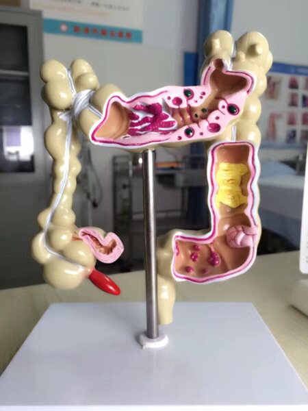全结肠疾病模型/正品/假一罚十/进口原料/医学模型/肛肠科探针