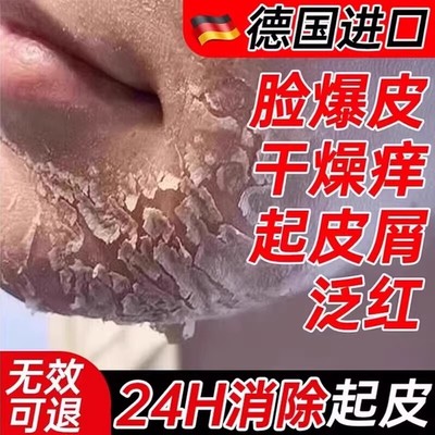 脱皮爆皮泛红保湿补水男面霜冬天