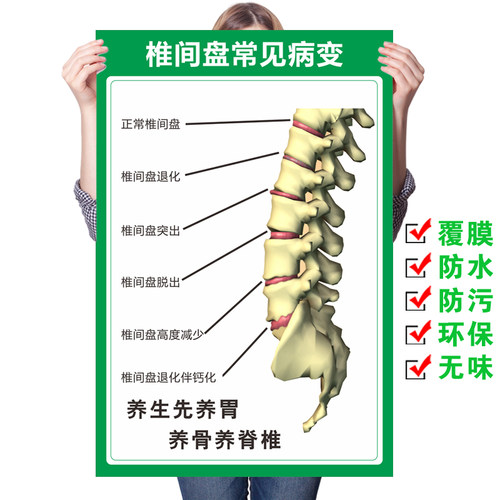 人体椎间盘常见病变颈椎 脊椎全息图 骨骼挂图医院腰椎间盘突墙贴 - 封面