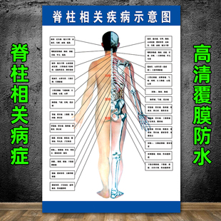 脊柱相关疾病示意图中医养生病理原因结构图挂图海报保健海报