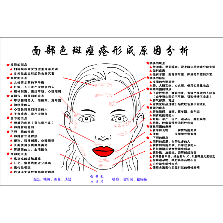 面部色斑与痤疮产生的原因图片 中医美容院养身SPA健康宣传海报