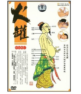 正版dvd碟片 中医理疗 火罐 火罐疗法名医示范 1DVD光盘