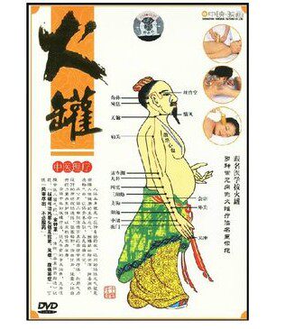 正版dvd碟片 中医理疗 火罐 火罐疗法名医示范 1DVD光盘