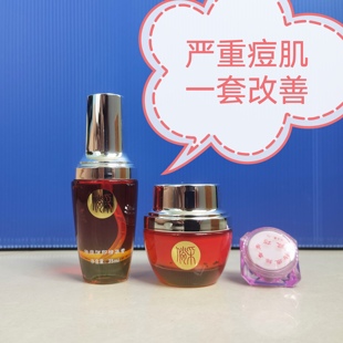 藏药祛痘套盒三件套组合去额头脸部痘痘下巴闭口粉刺的克星青春痘