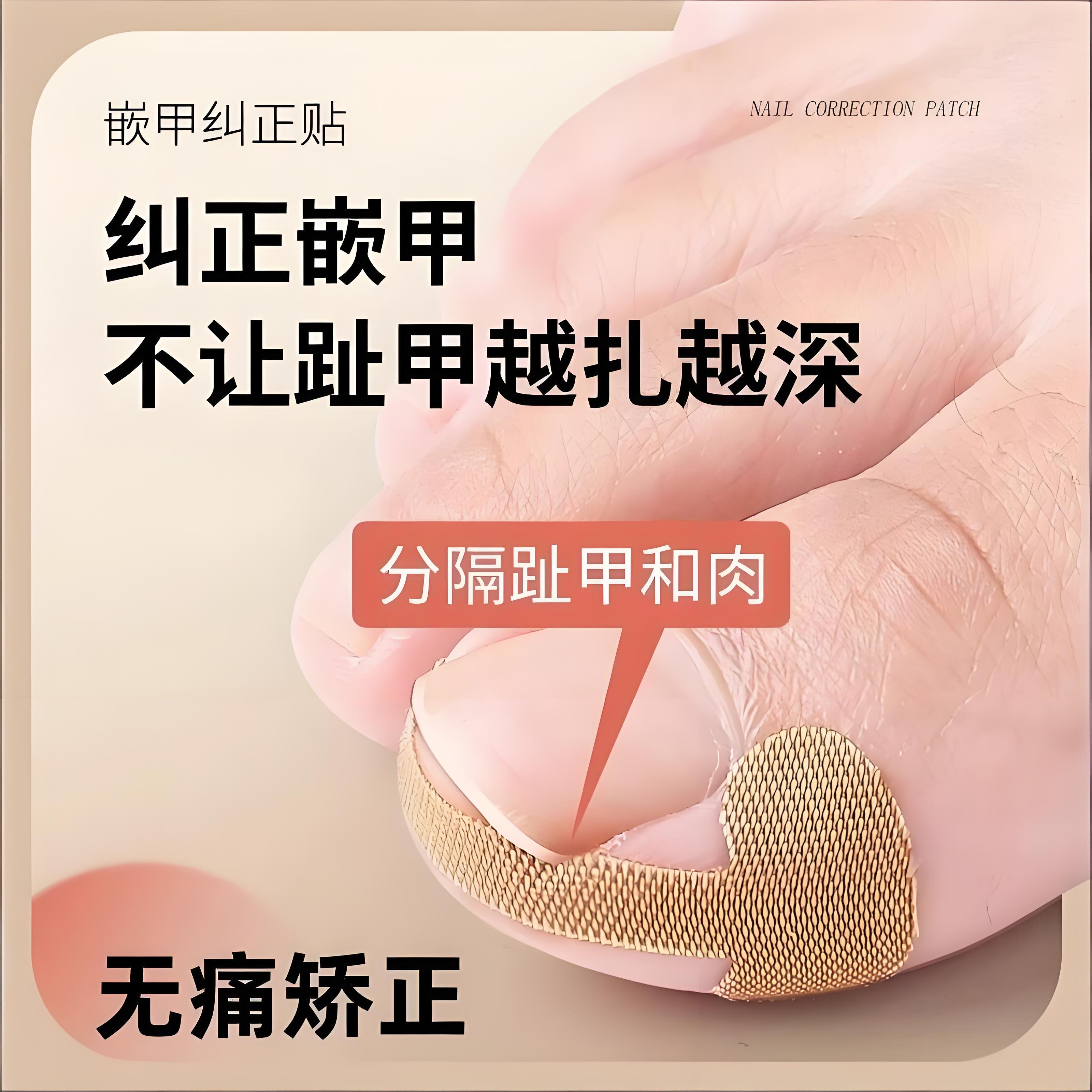 指甲矫正贴隔离脚趾甲长肉里