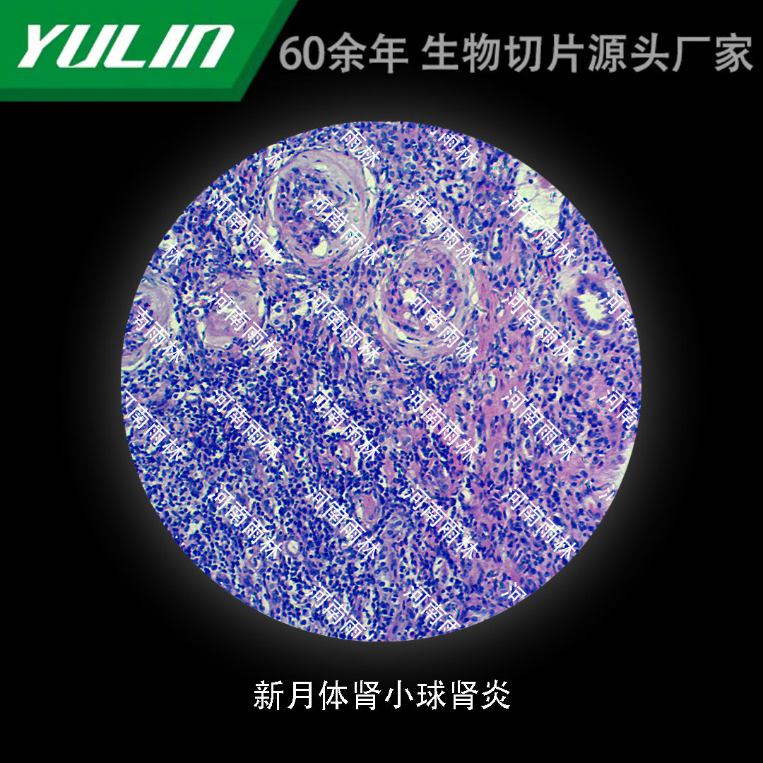 新月体肾小球肾炎生物标本切片动物植物细胞载玻片观察实验高校