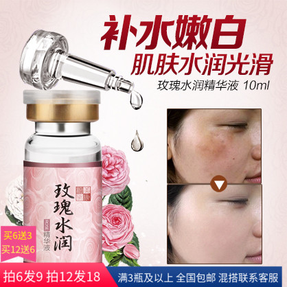 ÃÀ¿µ·Û÷ìõ¹åË®È󾫻ªÒº10ml²¹Ë®ÄÛ°×ìî¸ÉÔïÇÌÆ¤È¥°µ»Æ´Ö²ÚÔÒº