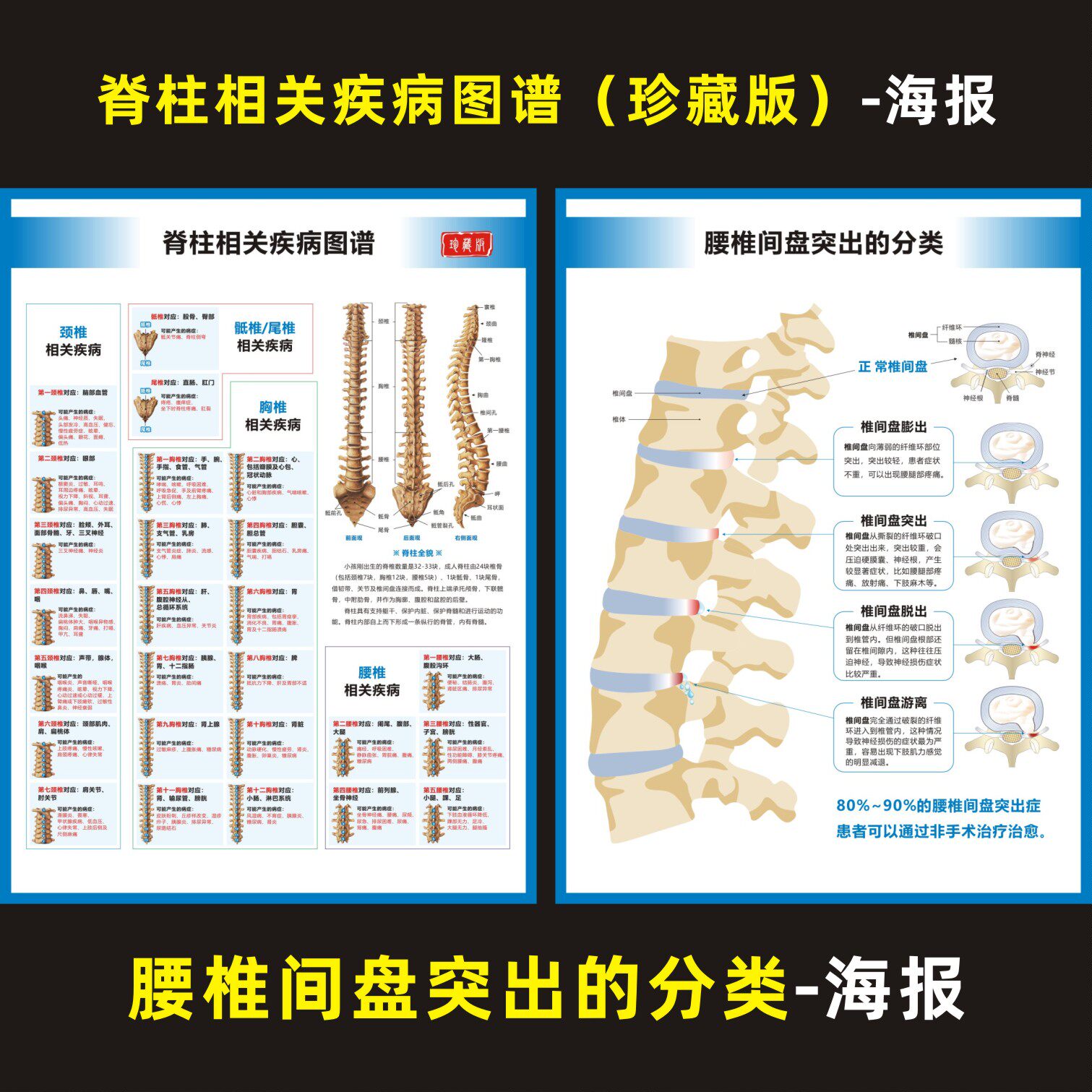 腰椎间盘突出分类脊柱相关疾病脊椎结构肌肉疼痛区压痛点挂图海报