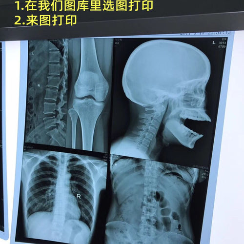 医用彩超光片打印电影小品道具
