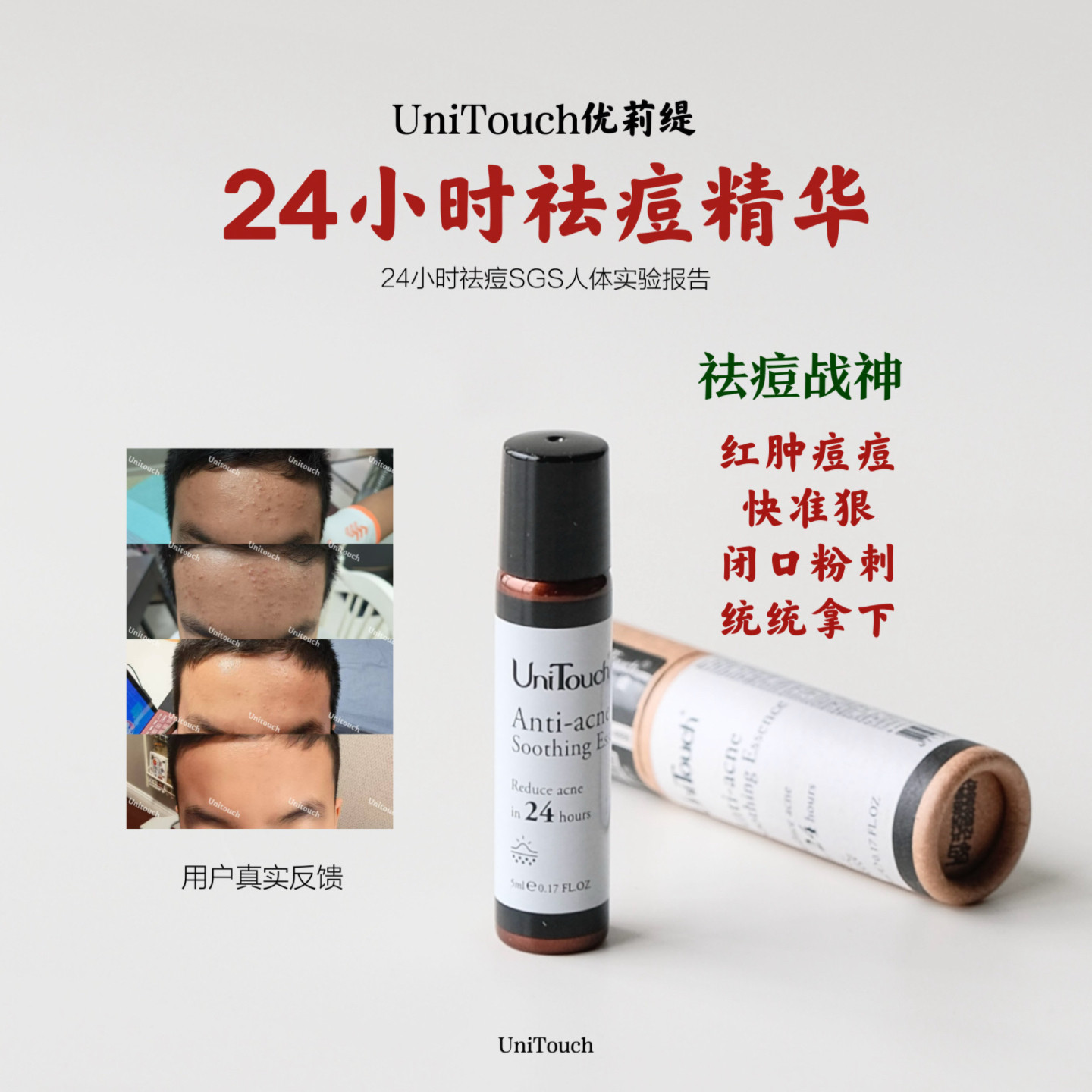 sgs人体实验24小时祛痘unitouch