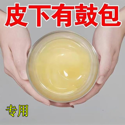 【正品香港脂肪康】皮下鼓包硬块肿块单发性多发性涂抹膏脂肪灵膏