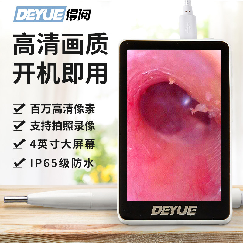 老巷子得阅采耳可视耳镜可视化耳朵耳道内窥镜摄像头仪器