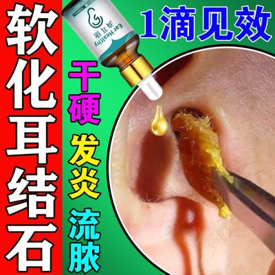 耳结石软化水取耳屎软化滴耳液治疗耳耵聍软化剂神器耳朵清洁药水