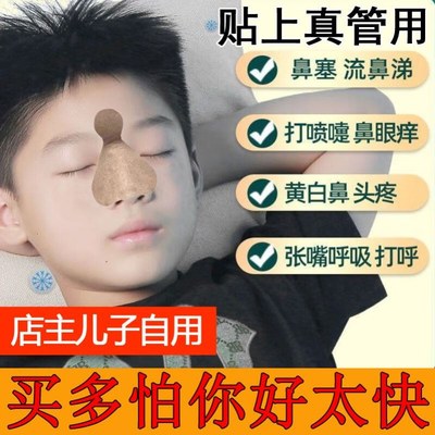 通鼻贴儿童专用过敏性鼻子炎贴鼻堵塞鼻甲大打喷嚏苍耳子油无激素