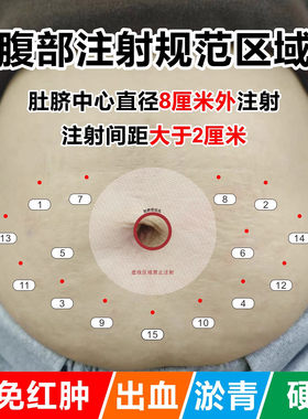 低分子肝素辅助定位卡