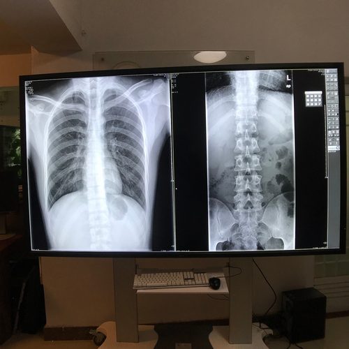 日电 NEC高清大屏4K显示器医疗会诊液晶屏 86寸 M861 98寸 M981