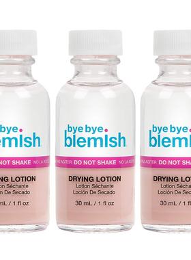 US直邮 Bye Bye Blemish Acne Drying Lotion瑕疵痘痘干燥化妆水