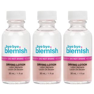US直邮 Bye Bye Blemish Acne Drying Lotion瑕疵痘痘干燥化妆水