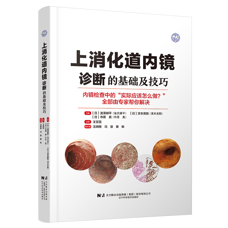 现货正版 上消化道内镜诊断的基础及技巧内镜诊断与鉴别诊断图谱手术操作教程肠胃镜检查操作手册食管胃溃疡胃病鉴别诊断书籍