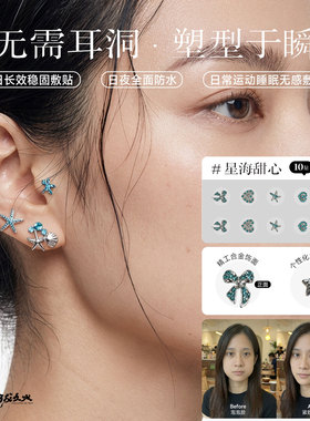 日韩同步供应同款耳穴贴 V脸 瞬间速提-星海甜心-合金款