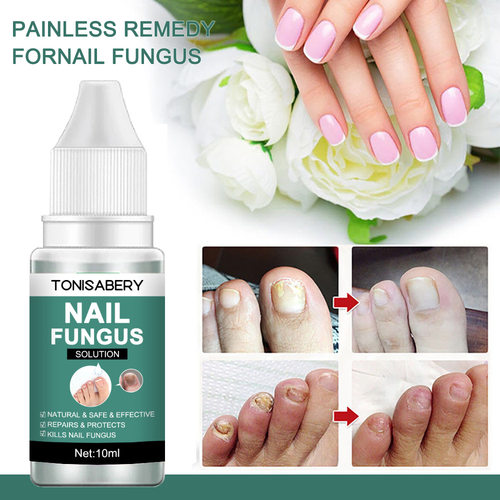 Nail Fungal Treatment Feet Care Essence Anti Infection Paro