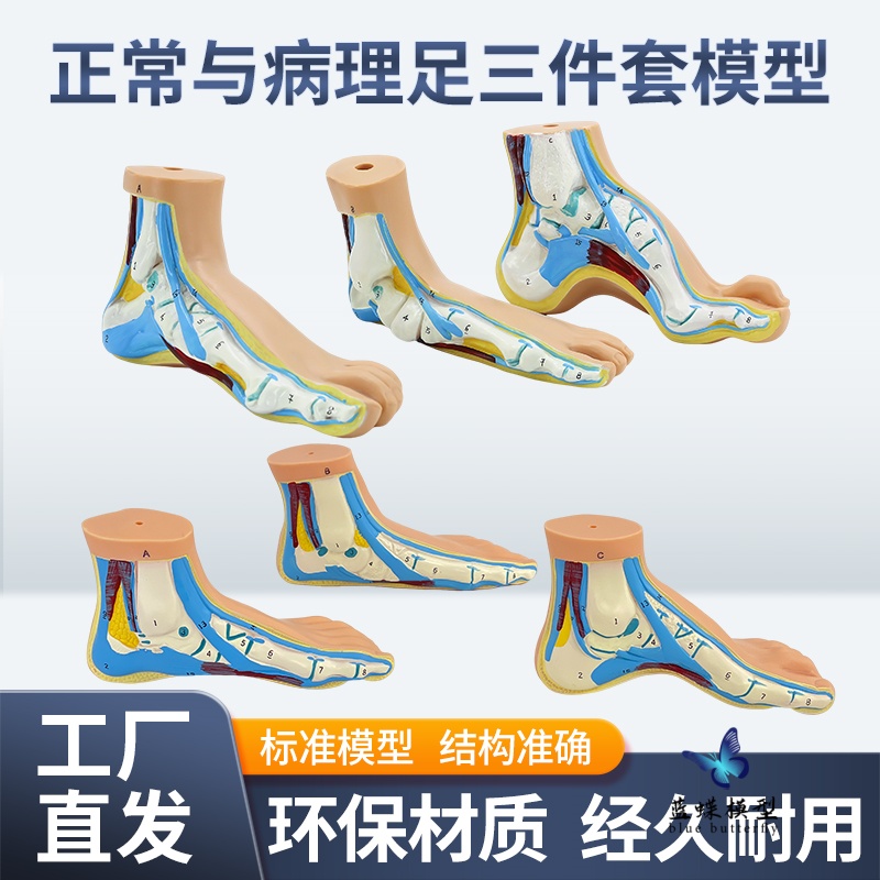 蓝蝶模型正常足扁平足弓形足教具