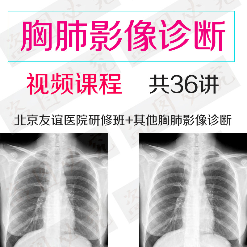 爆款推荐 胸肺影像诊断视频课程胸部肺部ct胸部x线影像读片指导