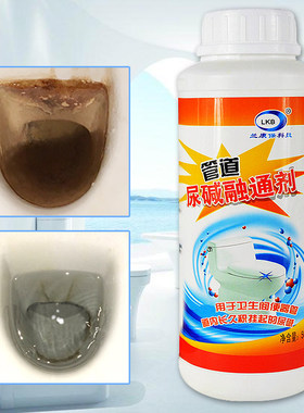 兰康保马桶尿碱垢清除疏通剂管道尿碱融通剂座便器蹲便厕所清洁剂