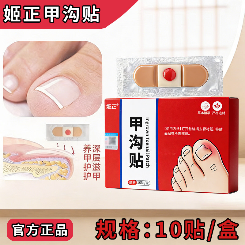 姬正甲沟贴矫正器正甲贴嵌甲脚指甲纠正器防趾甲长肉里专用隔离贴