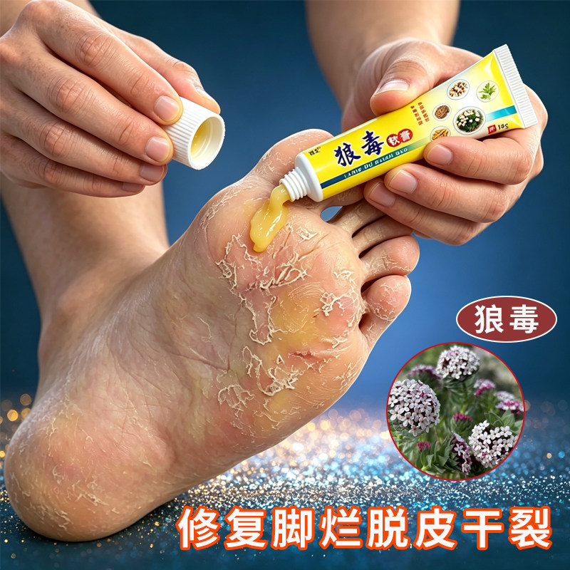 狼毒脚痒手部痒水泡脱皮烂脚丫脚臭除臭脚汗膏去痒乳膏