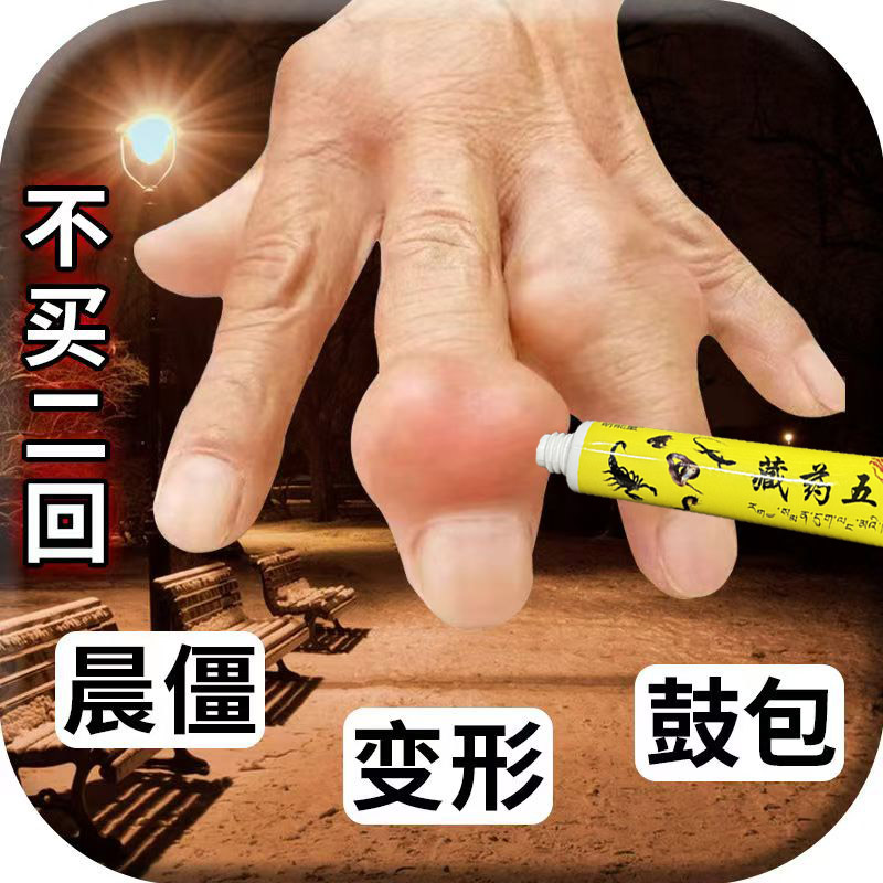 手指疼痛骨节粗大变形手指关节疙瘩鼓包骨关节肿大藏药五毒抑菌膏