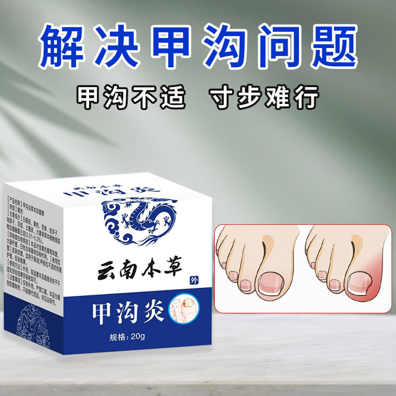 甲沟软甲嵌甲去肉芽脚趾息肉矫正器化脓肿温和不刺激