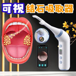 扁桃体结石去除工具隐窝冲洗器安全可视口腔清除仪神器电动吸取器