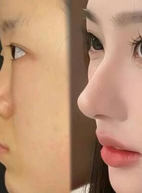 高鼻梁增山根瘦鼻头缩鼻翼女生大鼻头立体挺美鼻精华