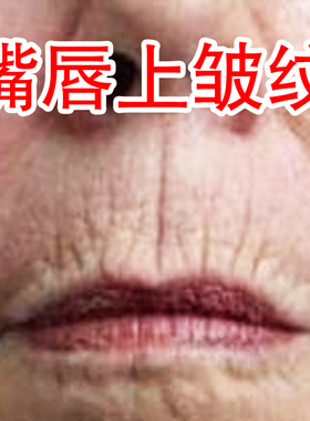 草本嘴唇皱纹精油 唇纹人中纹人中精华液眼纹抬头纹川字纹周口纹