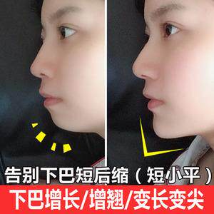 下巴增长精华 挺翘变长变尖改善后缩扁平 新客限拍一瓶拍多不发货
