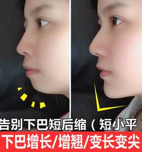下巴增长精华 挺翘变长变尖改善后缩扁平 新客限拍一瓶拍多不发货